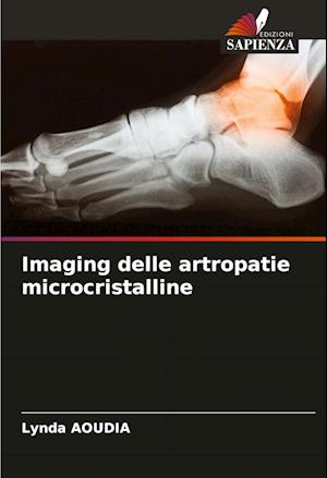 Imaging delle artropatie microcristalline