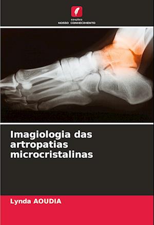 Imagiologia das artropatias microcristalinas