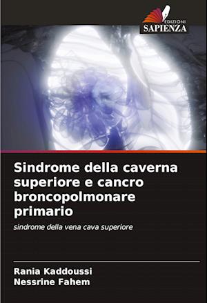 Sindrome della caverna superiore e cancro broncopolmonare primario