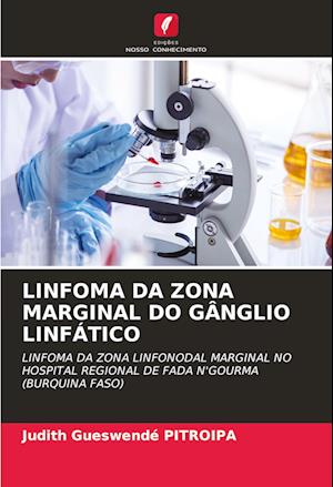 LINFOMA DA ZONA MARGINAL DO GÂNGLIO LINFÁTICO