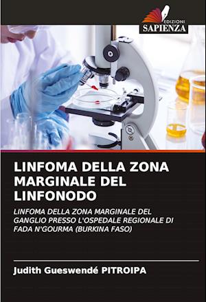 LINFOMA DELLA ZONA MARGINALE DEL LINFONODO