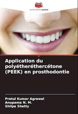 Application du polyétheréthercétone (PEEK) en prosthodontie