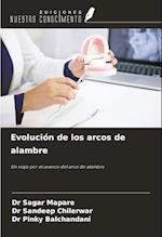 Evolución de los arcos de alambre