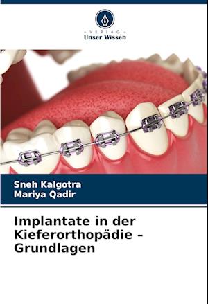 Implantate in der Kieferorthopädie ¿ Grundlagen