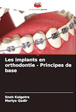 Les implants en orthodontie - Principes de base