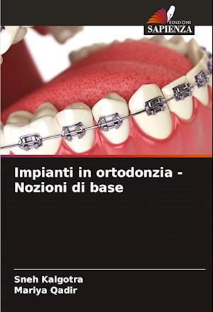 Impianti in ortodonzia - Nozioni di base