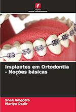 Implantes em Ortodontia - Noções básicas