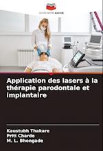 Application des lasers à la thérapie parodontale et implantaire