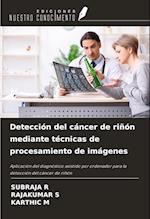 Detección del cáncer de riñón mediante técnicas de procesamiento de imágenes