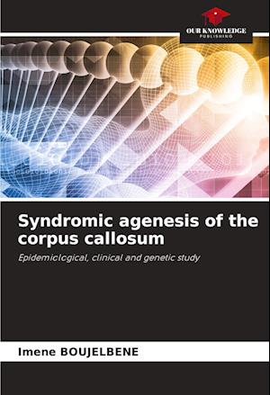 Syndromic agenesis of the corpus callosum