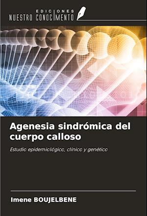 Agenesia sindrómica del cuerpo calloso