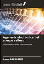 Agenesia sindrómica del cuerpo calloso