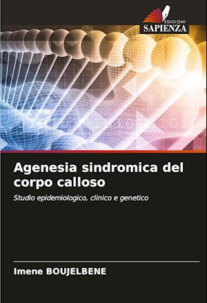 Agenesia sindromica del corpo calloso