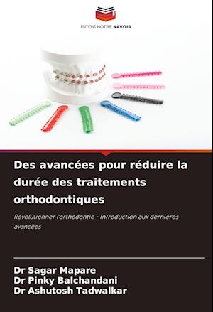 Des avancées pour réduire la durée des traitements orthodontiques