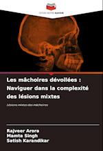 Les mâchoires dévoilées : Naviguer dans la complexité des lésions mixtes