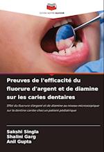 Preuves de l'efficacité du fluorure d'argent et de diamine sur les caries dentaires