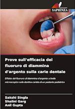 Prove sull'efficacia del fluoruro di diammina d'argento sulla carie dentale