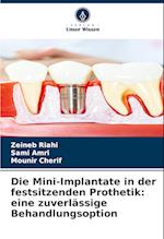 Die Mini-Implantate in der festsitzenden Prothetik: eine zuverlässige Behandlungsoption