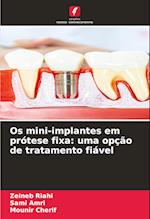 Os mini-implantes em prótese fixa: uma opção de tratamento fiável