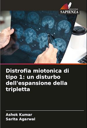 Distrofia miotonica di tipo 1: un disturbo dell'espansione della tripletta