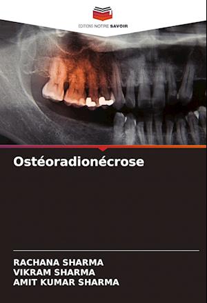 Ostéoradionécrose