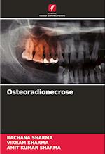 Osteoradionecrose