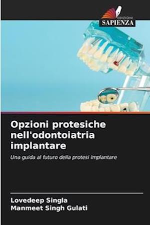 Opzioni protesiche nell'odontoiatria implantare