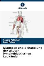 Diagnose und Behandlung der akuten lymphoblastischen Leukämie