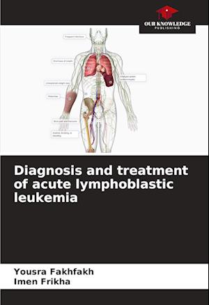 Diagnosis and treatment of acute lymphoblastic leukemia