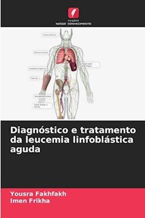 Diagnóstico e tratamento da leucemia linfoblástica aguda