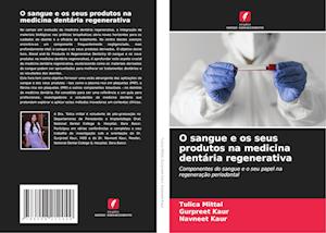 O sangue e os seus produtos na medicina dentária regenerativa