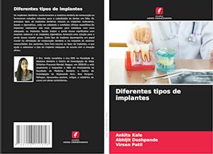 Diferentes tipos de implantes