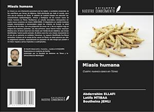 Miasis humana