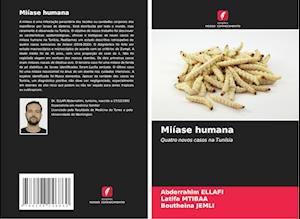 Miíase humana