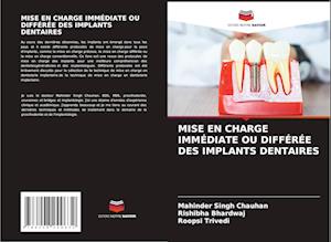 MISE EN CHARGE IMMÉDIATE OU DIFFÉRÉE DES IMPLANTS DENTAIRES