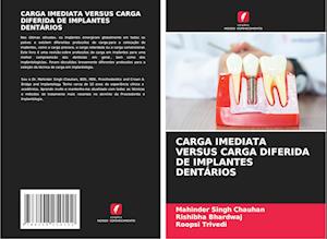 CARGA IMEDIATA VERSUS CARGA DIFERIDA DE IMPLANTES DENTÁRIOS