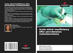 Acute mitral insufficiency after percutaneous commissurotomy