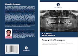 Sinuslift-Chirurgie