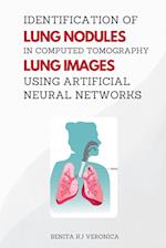 Identification of Lung Nodules in Computed Tomography Lung Images Using Artificial Neural Networks 