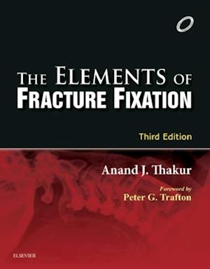 Elements of Fracture Fixation - E-book