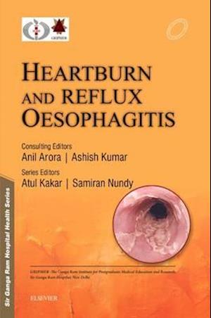 Sir Ganga Ram Hospital Health Series: Heartburn and Reflux Oesophagitis