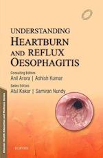 Understanding Heartburn and Reflux Oesophagitis