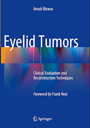 Eyelid Tumors