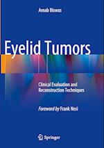 Eyelid Tumors