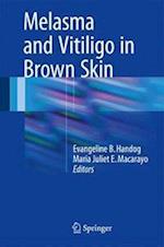 Melasma and Vitiligo in Brown Skin