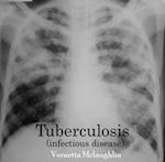 Tuberculosis(infectious disease)