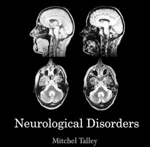 Neurological Disorders