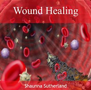 Wound Healing