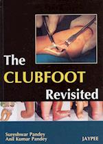 The Club Foot Revisited