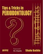Tips and Tricks in Periodontology
